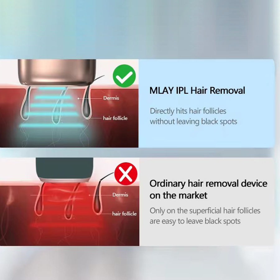 Mlay T10 High Quality Portable Smart Hair Removal Laser Unlimited Flashes With Sapphire Ice Cooling IPL Hair Removal for Home