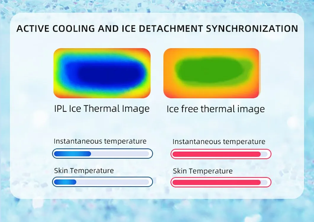 Customization OEM Manual Flash Handle IPL Laser Hair Removal Appliances Epilator Machine