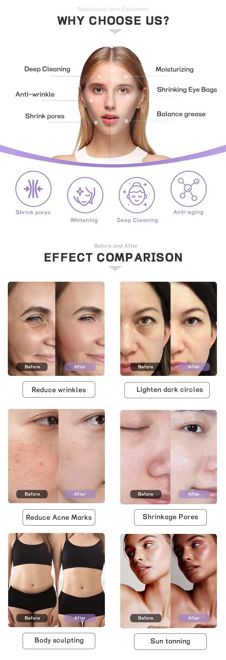 Hot Sale Opt Hair Removal Instrument IPL Skin Rejuvenation Wrinkle Smooth Pigment Elimination Painless Epilation Instrument