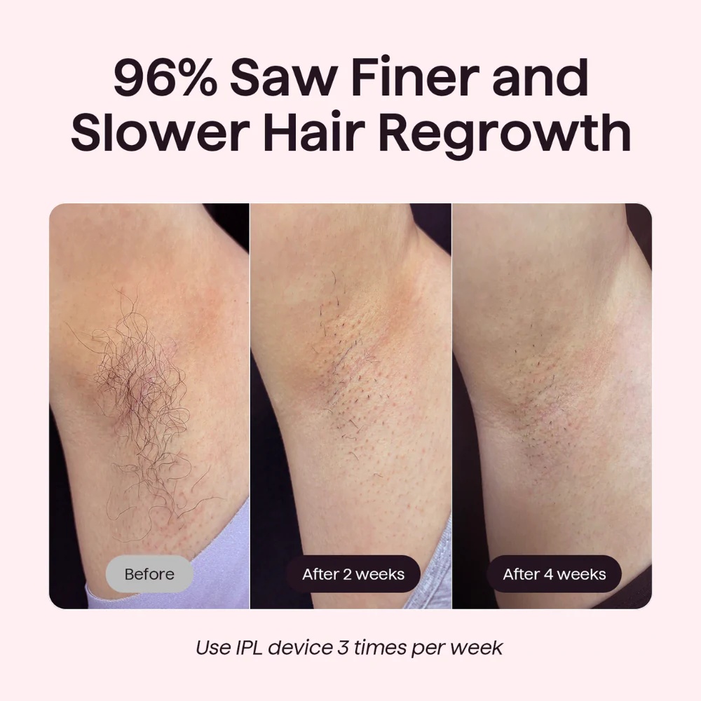 Mini Painless Ice Cooling IPL Hair Removal Max 24J High Energy Laser Hair Removal Machine for Face Bikini Line Armpit Leg Back