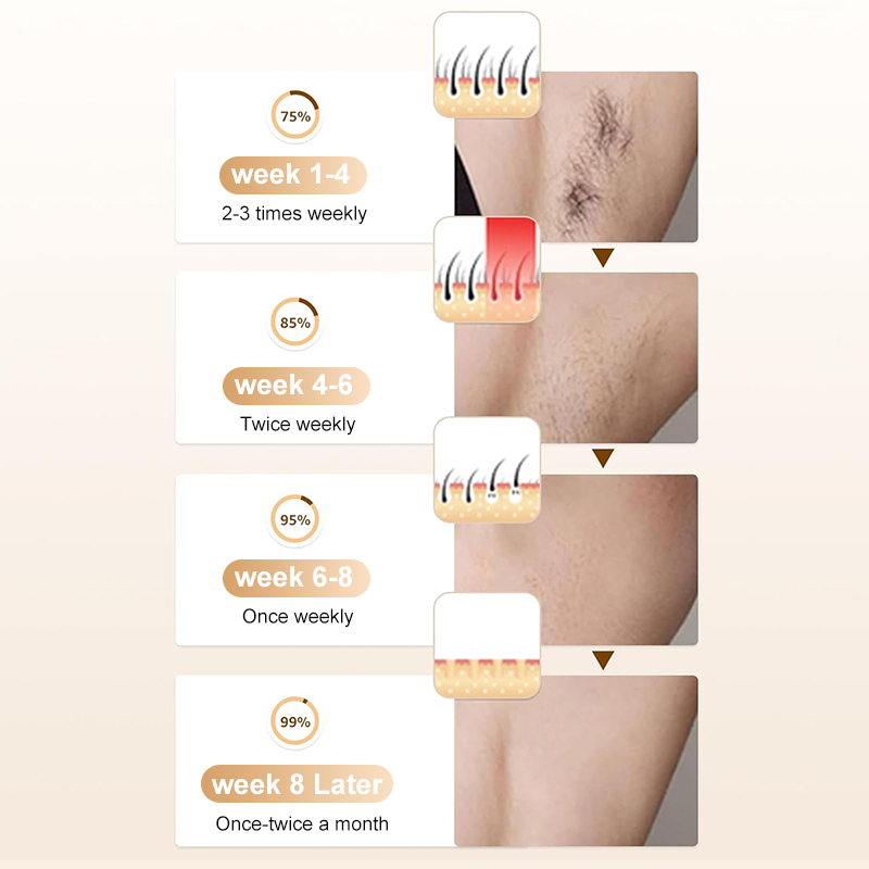Handheld Gun Shape ABS IPL Hair Removal Device Ice Cooling Painless Full Body At-Home Hair Remover