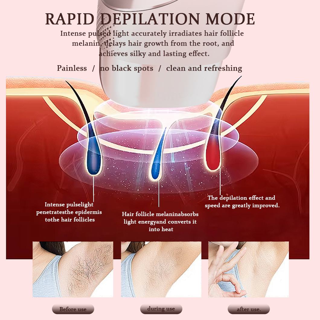 Fasiz New Trend Special Design Automatic Skin Color Recognition Ice Ipl Laser Hair Removal for Home Use