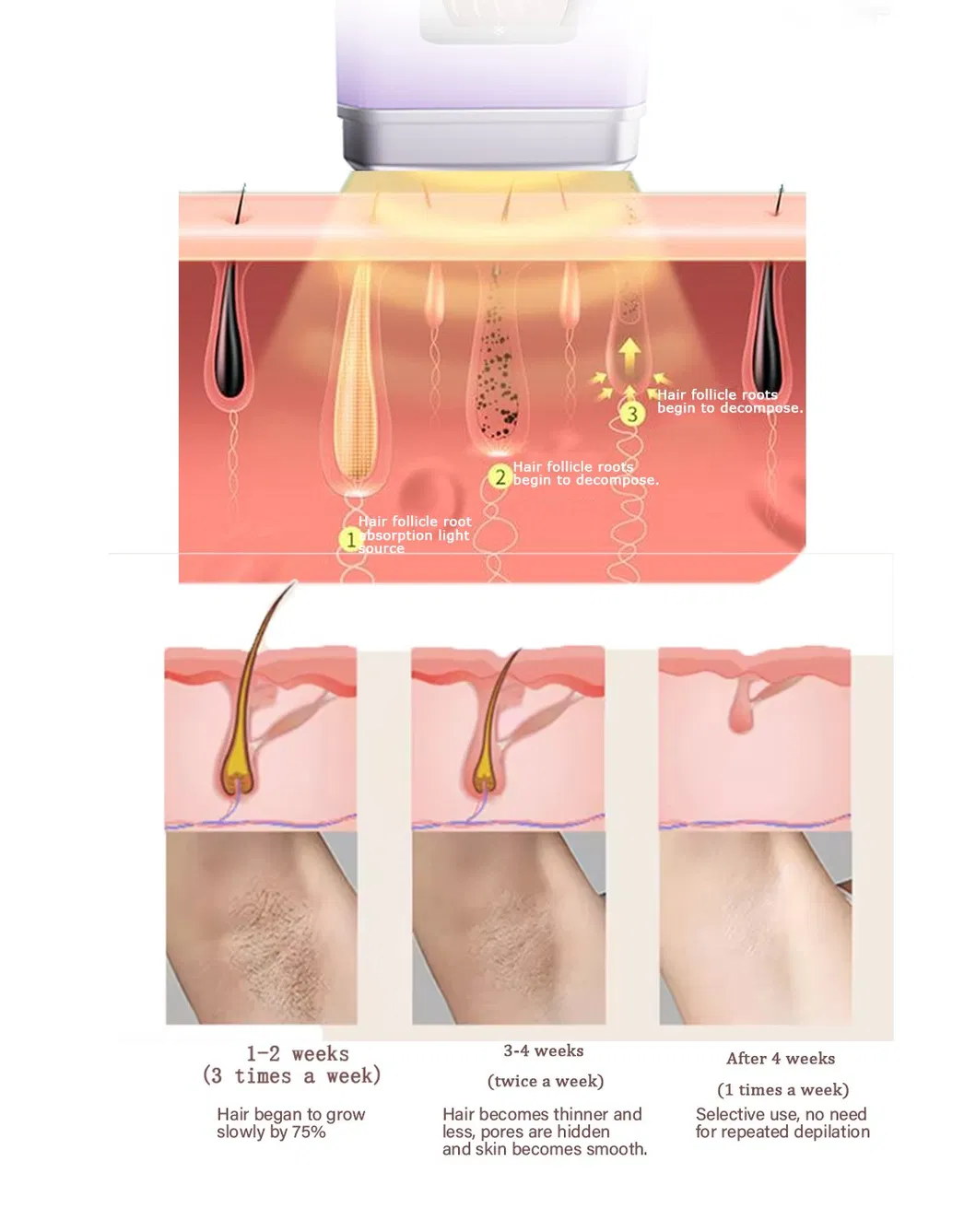 Dust Cover and Safety Features