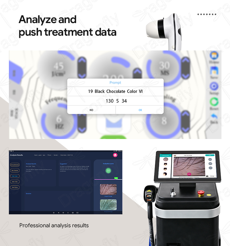 Automatic Parameter Setting