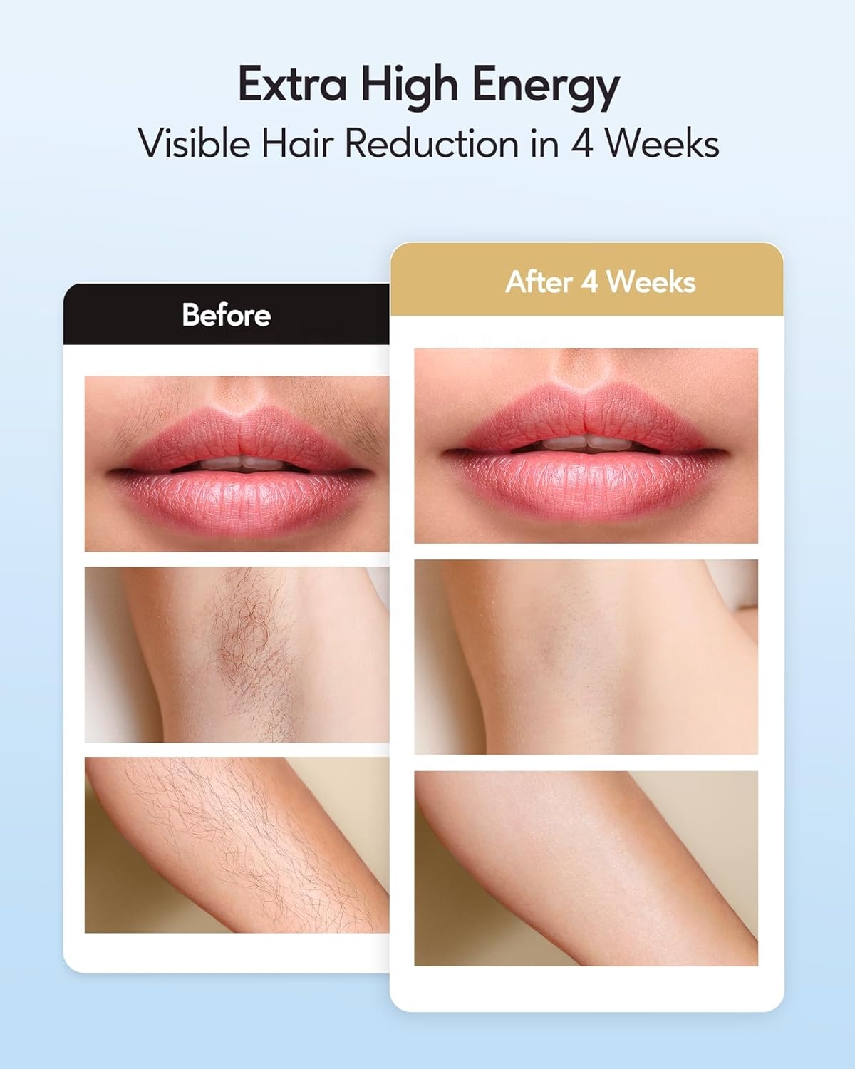 INNZA IPL Cooling Lazer Auto Shot Hair Removal Device Depiladora Laser 999,999 Flashes Painless Hair Remover