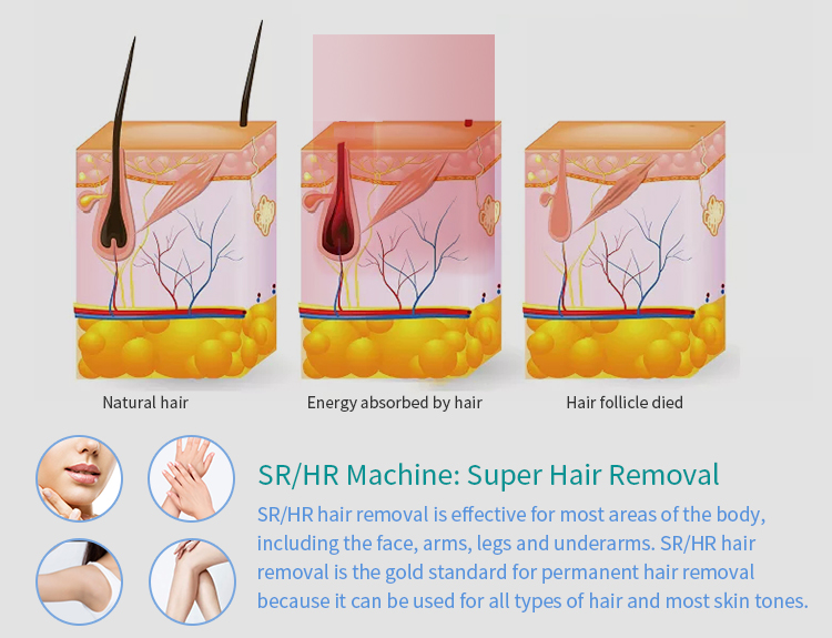 2024 Professional OEM/ODM Ipl Opt Skin Care Rejuvenation Machine Portable Elight IPL Hair Removal Machine