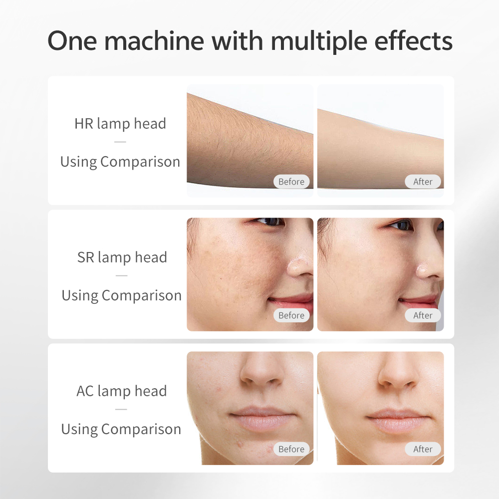 Mlay Mini IPL Laser Hair Removal Device Whole Body Home Use Personal Pulsed Acne Treatment Pigment Removal Permanent UK/US