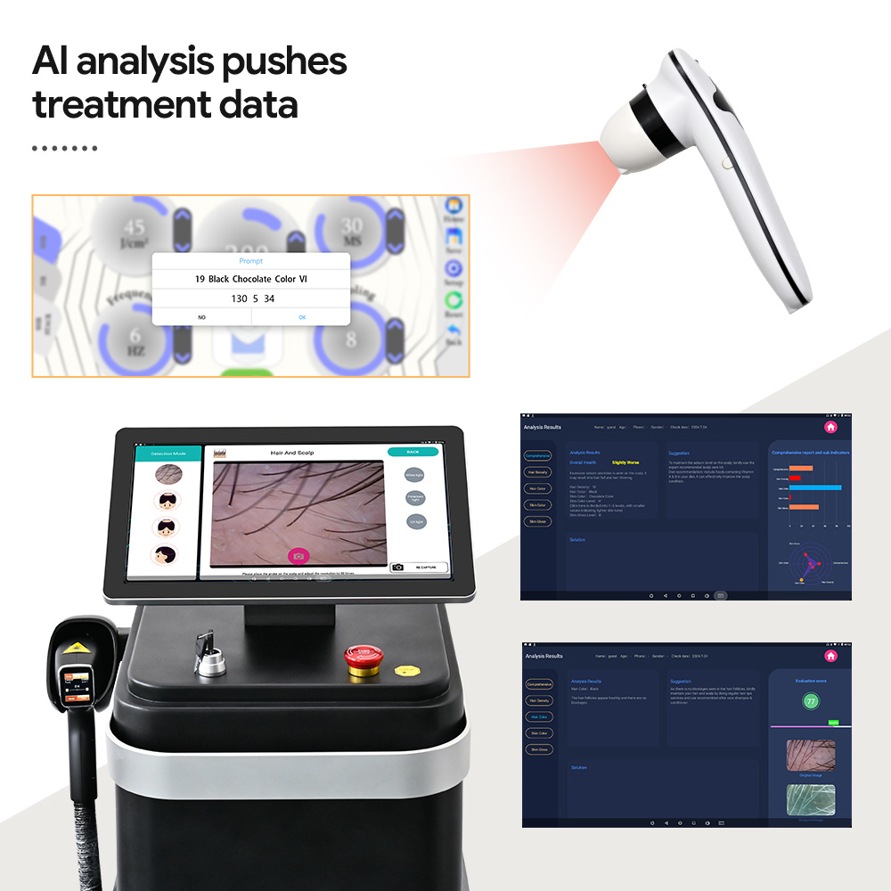 2025 Newest AI ICE 3 Waves 755nm 808nm 1064nm Diode Laser Hair Removal Machine 1000W 500W Portable Stationary Beauty Device
