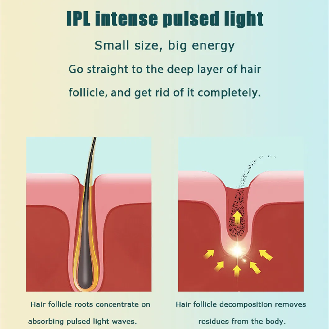 2024 New IPL High Quality Strong Pulse Laser Hair Removal Instrument