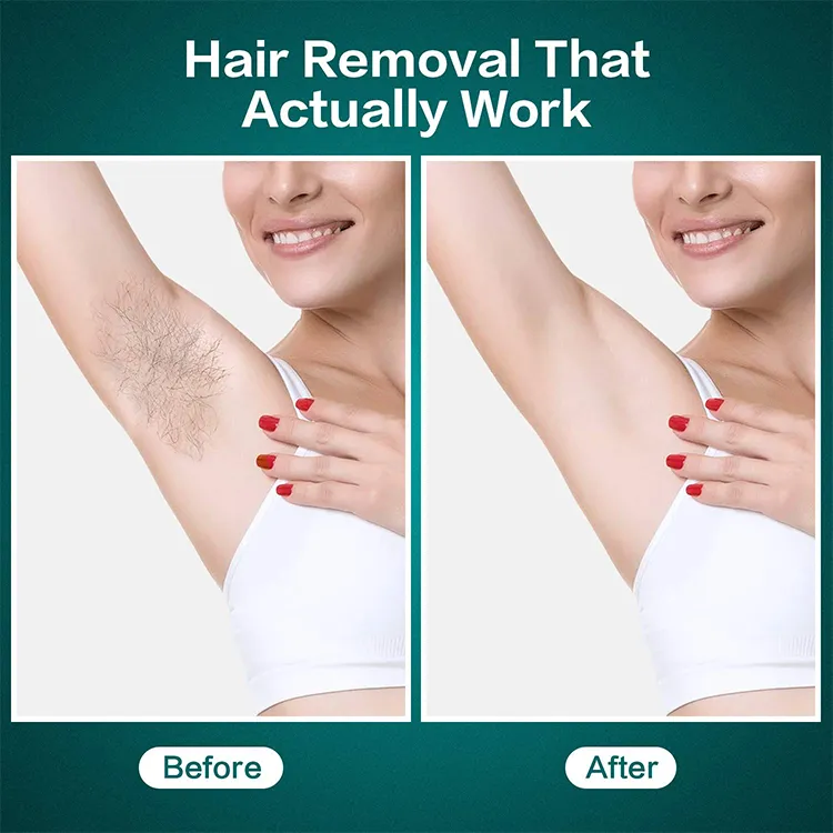 Permanent Painless Epilator Laser Portable Hair Remover IPL Hair Removal Device