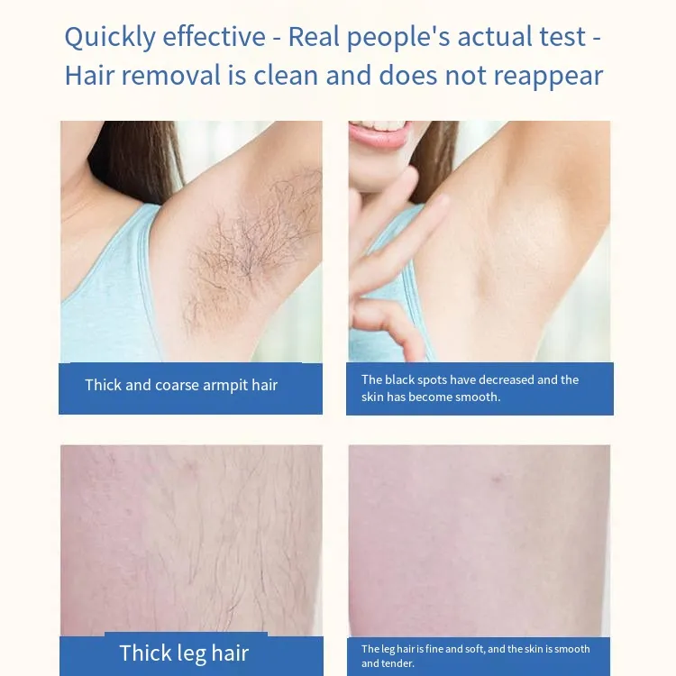 Portable Women IPL Laser Body Hair Removal Device