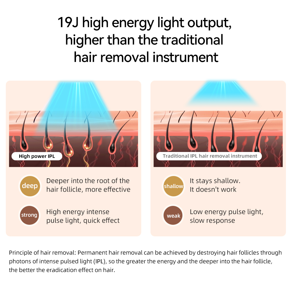 Sapphire IPL Hair Removal Device - 9&deg;C Cooling Tech Smart LCD Display 3 Cleared Replaceable Heads Painless Hair Reduction