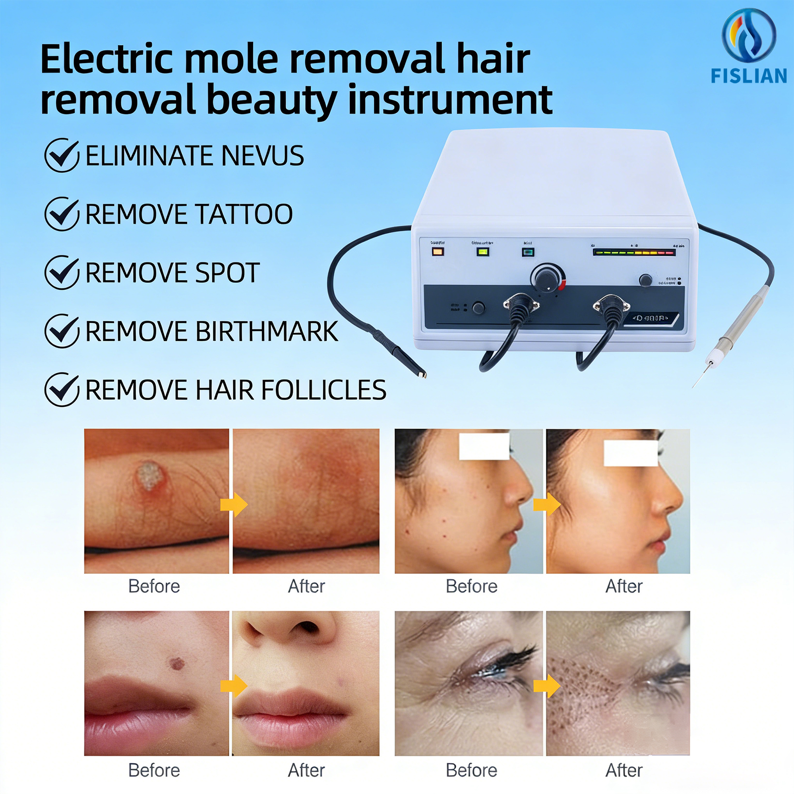 All-in-One Electrolysis Hair Removal System Portable Desktop Machine for Permanent Hair Removal on Face and Body