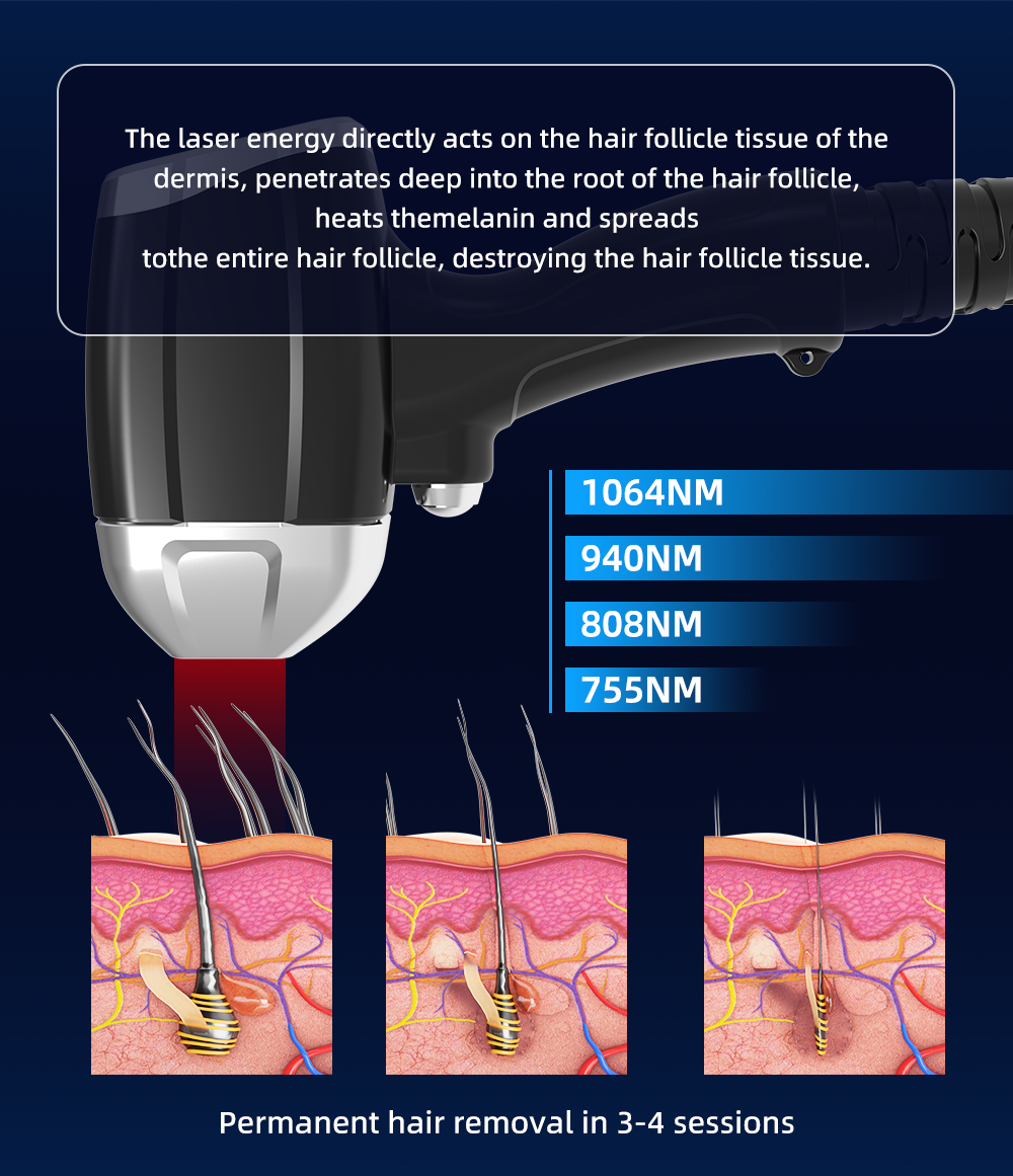 Most Advanced 4 Wave 808 Diode Laser Depilacion Hair Laser Removal Diodo Machine Professional Diode Ice Laser 4 Wave