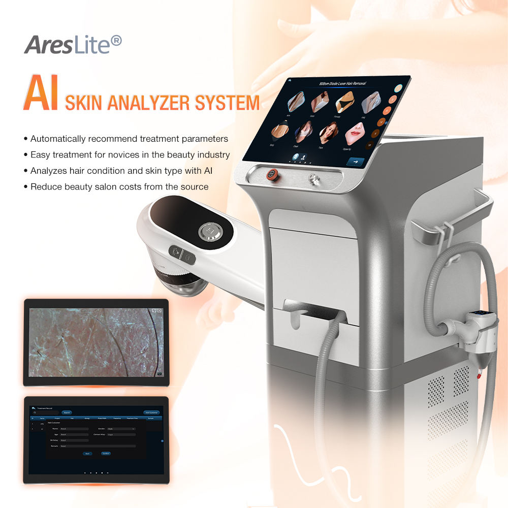 Professional Best 3000W 808nm Ai Diode Laser Hair Removal Machine 4 Wave Permanent Painless DCS Ice With 4 Replaceable Spot Size