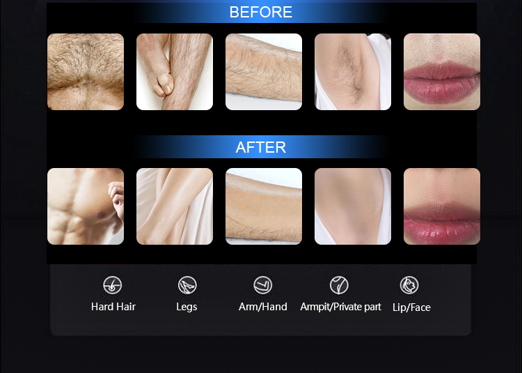Painless treatment guide