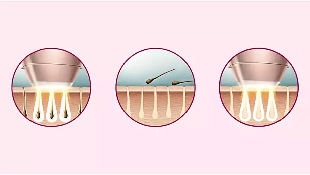 Sapphire Cooling Smooth Skin Treatment