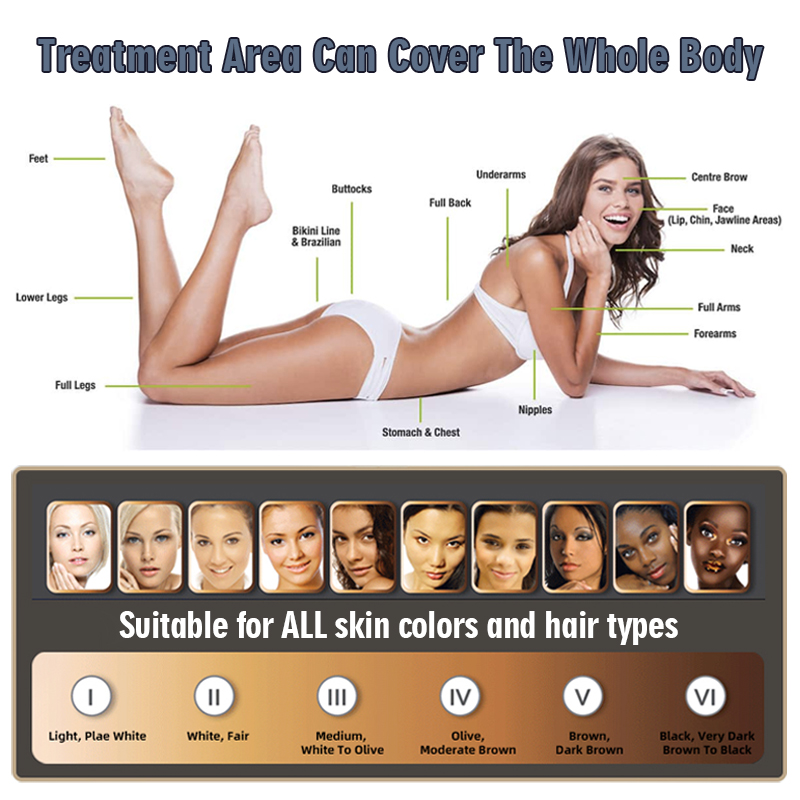 Portable IPL Laser Hair Removal Machine Machine Pigment Therapy Acne Spot Removal