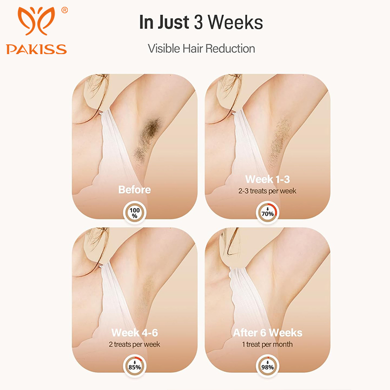 PAKISS At-Home IPL Hair Remover - HR+SR+RA for Underarm/Bikini Line/Leg Hair Removal