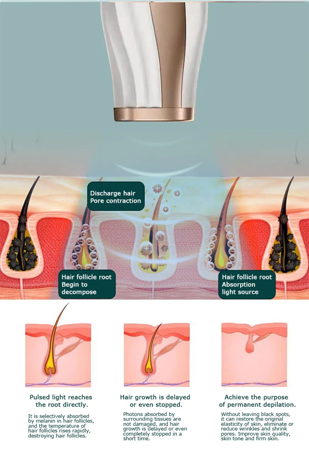 High Quality Luxury Facial and Body Freezing Point Laser Permanent Hair Removal