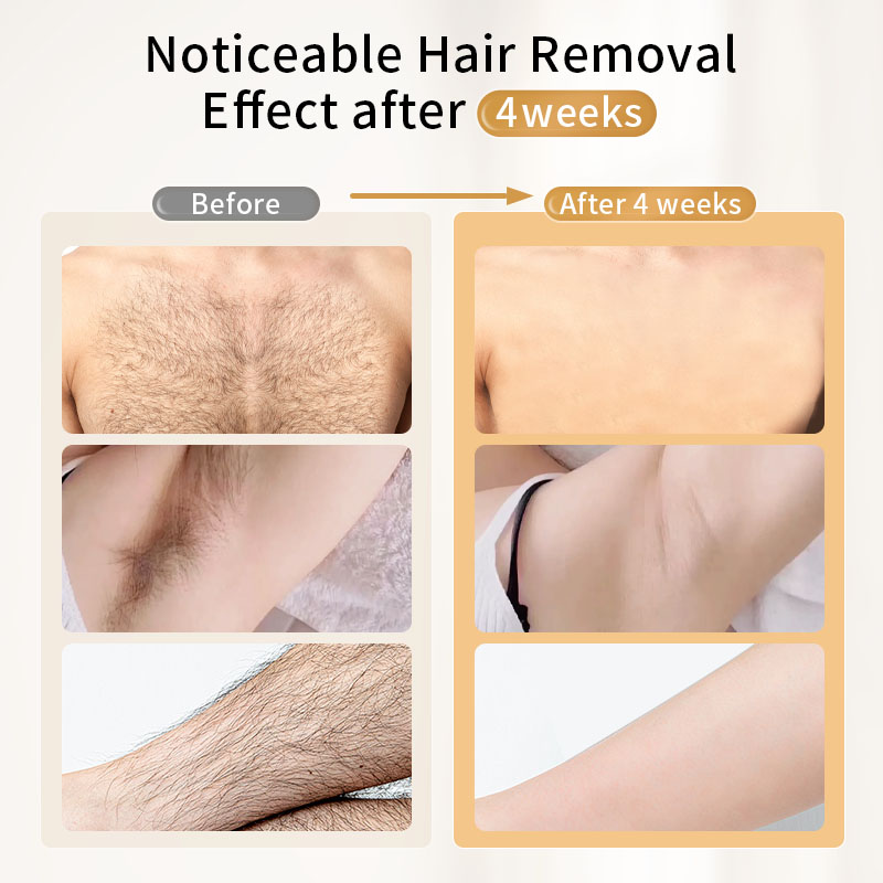 Moolweel T003 Mini New Generation Laser Ipl Permanent Hair Removal Machine Price Portable Smart Home Devices and Technology