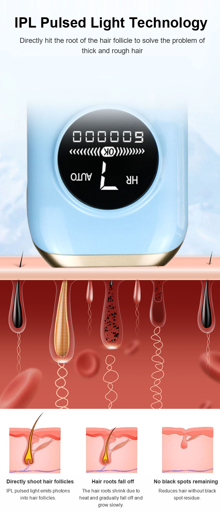 Gentle hair removal application