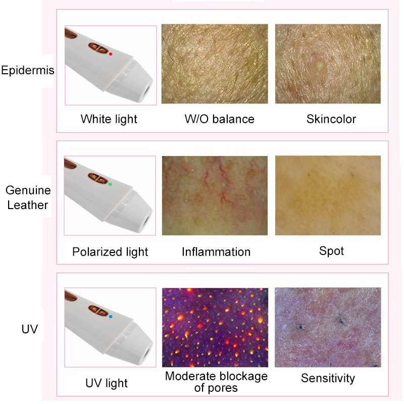 80X | 2MP Portable Skin Analyzer Machine 3-Color Light Customizable Colors Effortless Beauty &amp; Personal Care Machine