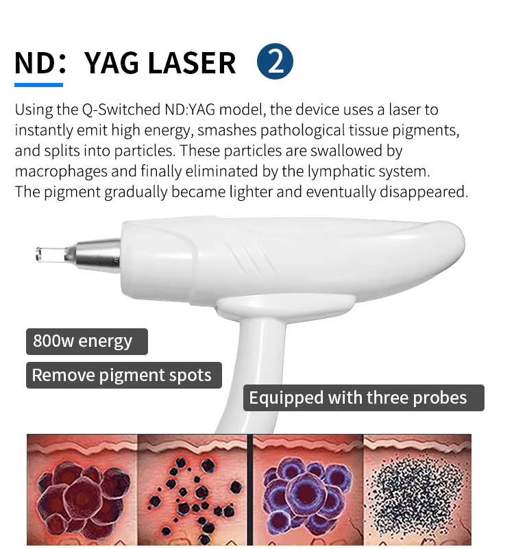 Permanent Hair Removal Equipment Hair Removal Machine Skin Rejuvenation Permanent Hair and Tattoo Removal Machine