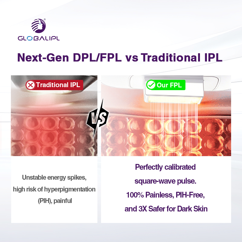 Professional Dpl Ipl Opt Laser Hair Removal Photorejuvenation Beauty Machine