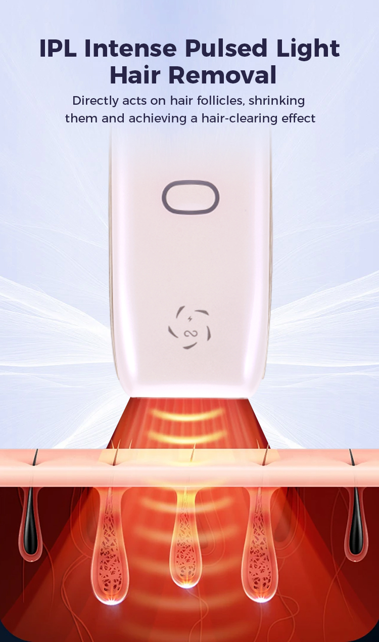 IPL Hair Removal Device View 2