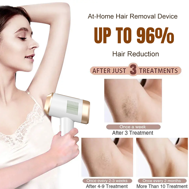 JIAWANG JW-515 Handheld Gun Shape ABS IPL Hair Removal Device Ice Cooling Painless Technology Full Body At-Home Use Custom Logo