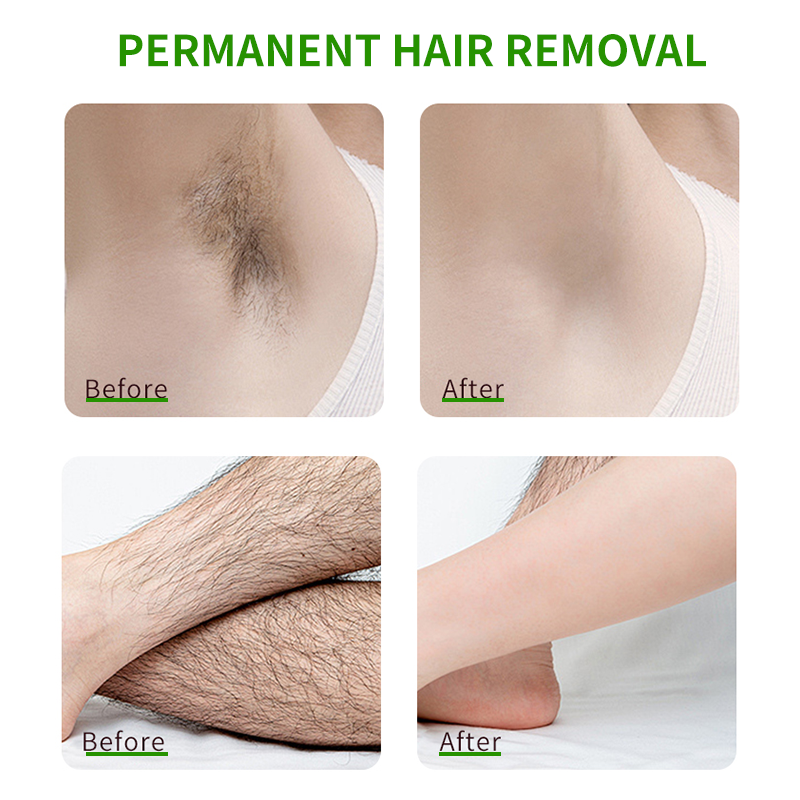 Clear Skin Moisturizing Hair Removal Cream Gentle Body Hair Remover For Arms Legs Underarms Hands Hydrating Non-Irritating