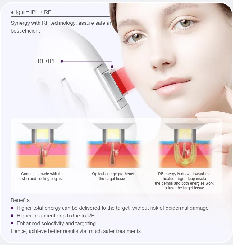 Portable IPL / Dpl Laser Hair Removal Device Detail 8