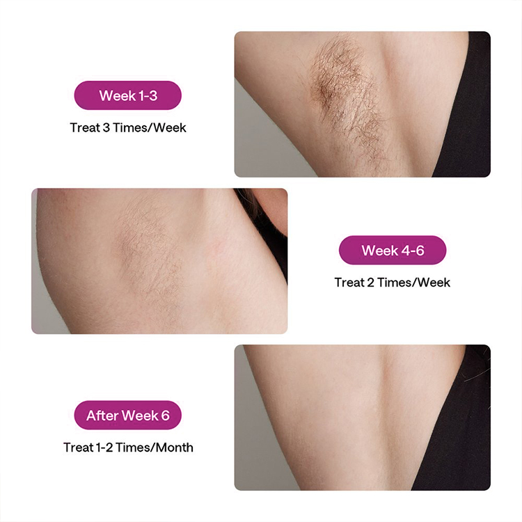 Skin care 24J permanent CE USA shave clean bikini hair Sapphire Ice cooling no pain permanent IPL Hair Removal