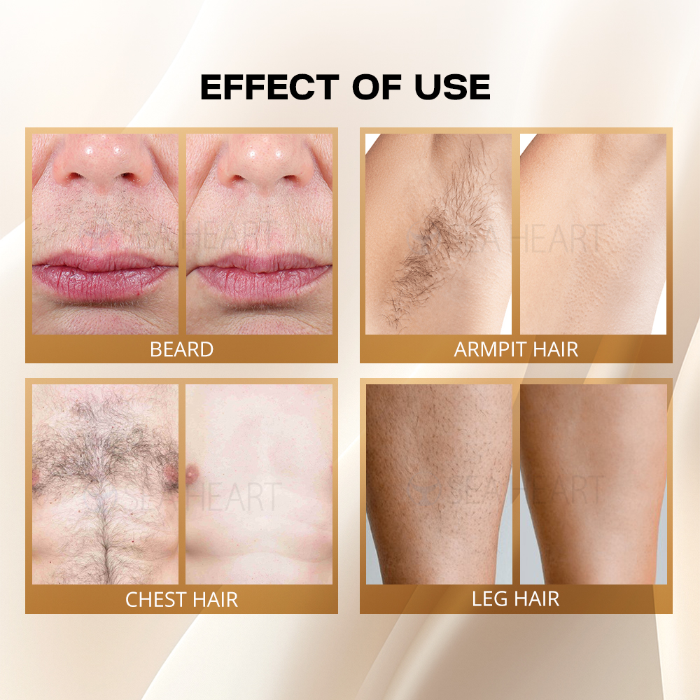 Hot Beijing Seaheart CE Approved 808nm Diode Laser Hair Removal No Pain Beauty Device For Commercial Use 2-Year Warranty
