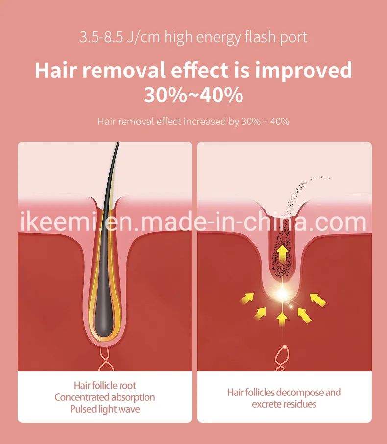 IPL Hair Removal Device Levels