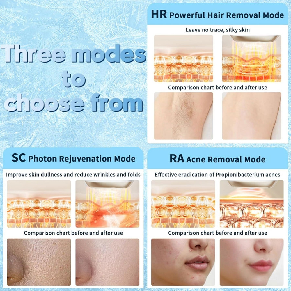 Fast Flash Permanent Hair Removal Device 9 Levels Energy Painless Hair Removal Women Epilator for Face Body OEM ODM Manufacturer