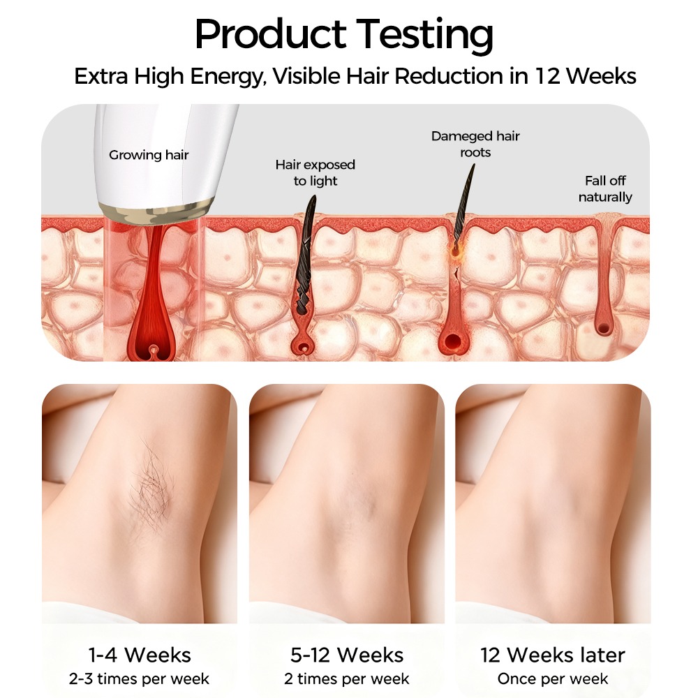 Professional High Energy 28J IPL Handheld Hair Removal Device with Smart Skin Sensor Ice Cooling for Home Use Body Treatment