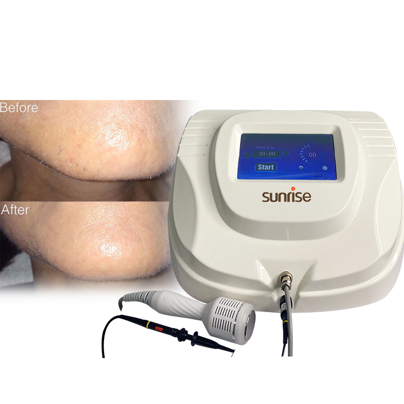 Aplus Non Invasive Electrolyse Permanent Hair Removal with 100 Free Needles Hair Follicle Removal