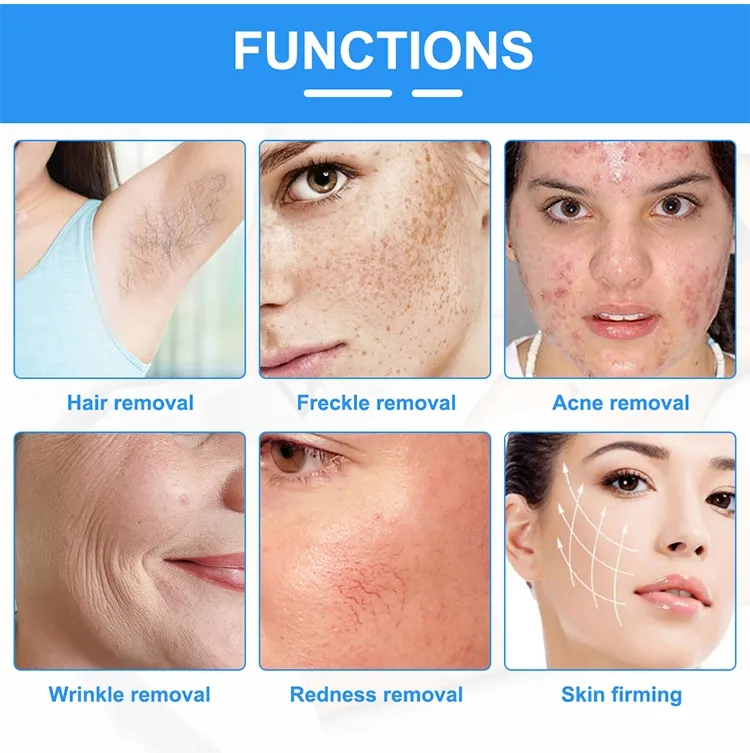 Hot Sale Opt Hair Removal Instrument IPL Skin Rejuvenation Wrinkle Smooth Pigment Elimination Painless Epilation Instrument