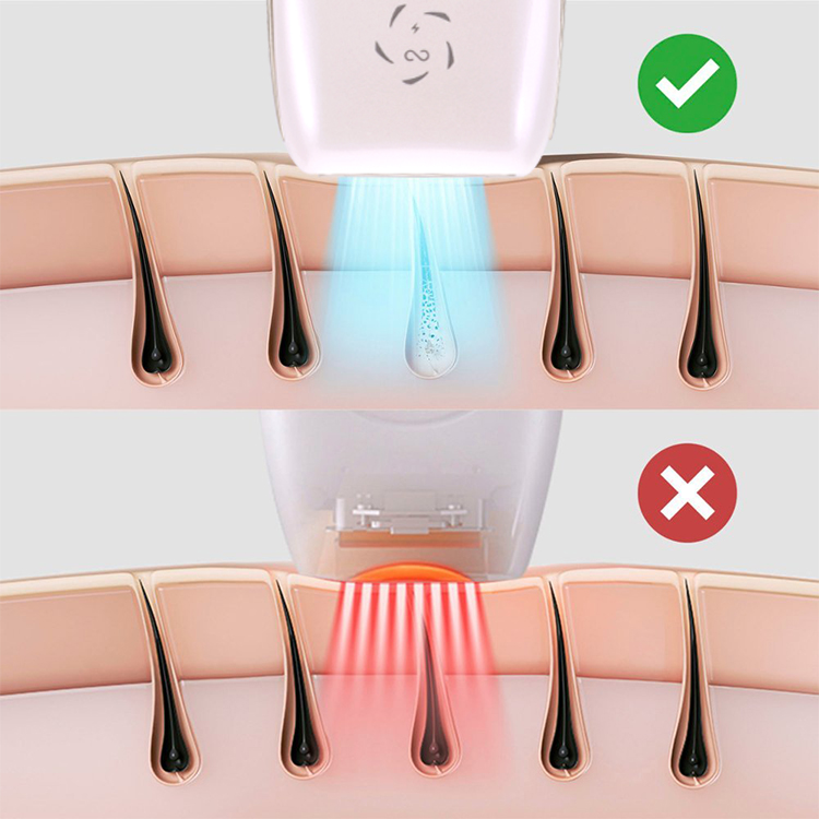 990000 Facial Hair Clean Shave Medical Permanent Removal Hair Body Clean Bikini Line Sapphire Ice Cooling IPL Hair Removal
