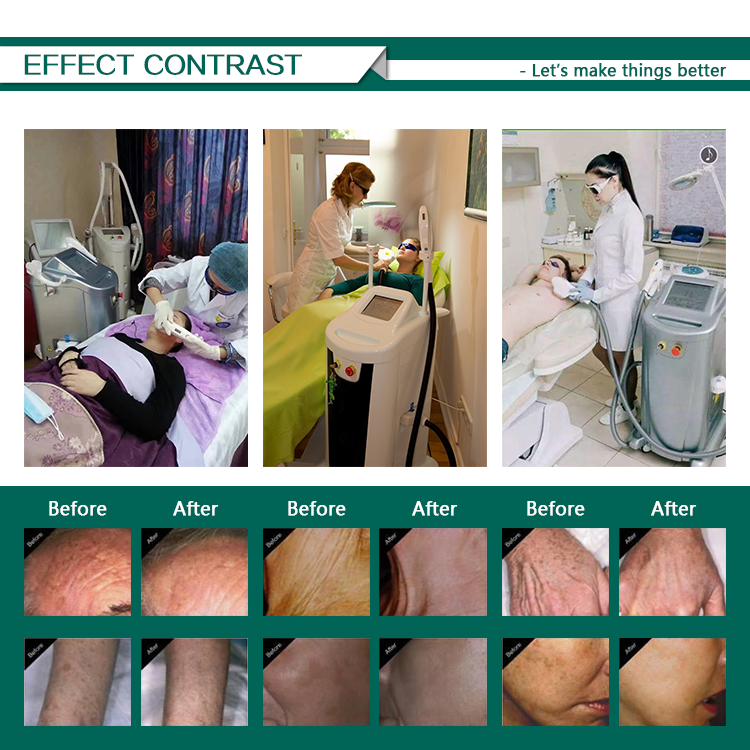 Before and After Image 1