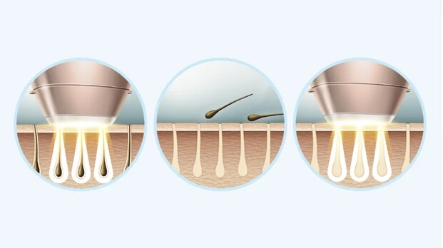 How IPL Works Diagram