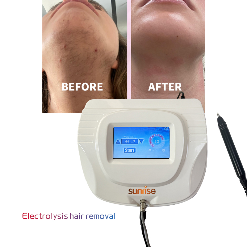 Best Price Electrolysis White Hair Removal with 0.01mm Electrolyse Needles Beauty Machine