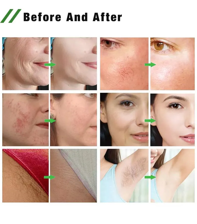 Multifunctional 3 Filters Skin Rejuvenation and Firm Permanent IPL Hair Removal Device Portable