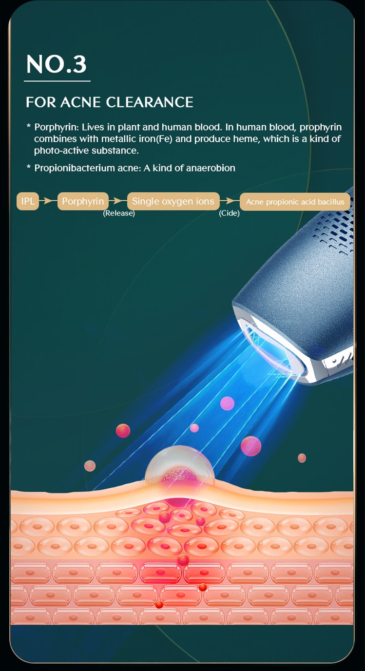 Painless hair removal design technology