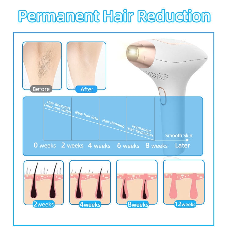 2026 High-Quality Portable Factory IPL Hair Removal Laser Device