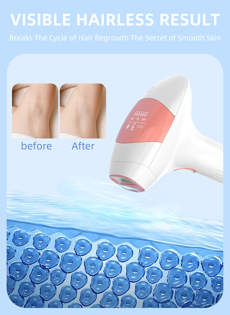 IPL Hair Removal Device View 6