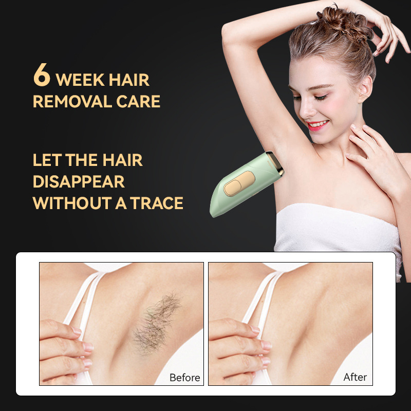 Permanent IPL Hair Removal Machine Skin Rejuvenation Armpit Small Ice Cooling Home Use Customized Label