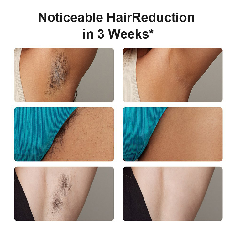 Skin care 24J permanent CE USA shave clean bikini hair Sapphire Ice cooling no pain permanent IPL Hair Removal